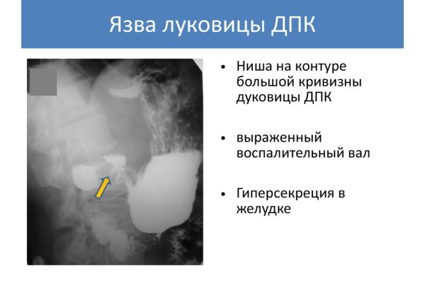 Kraken tor зеркало